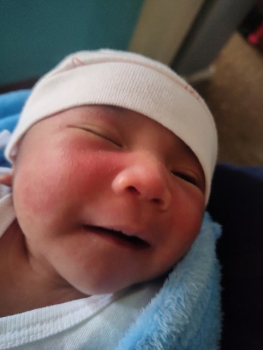 Rashes na normal ba ito?