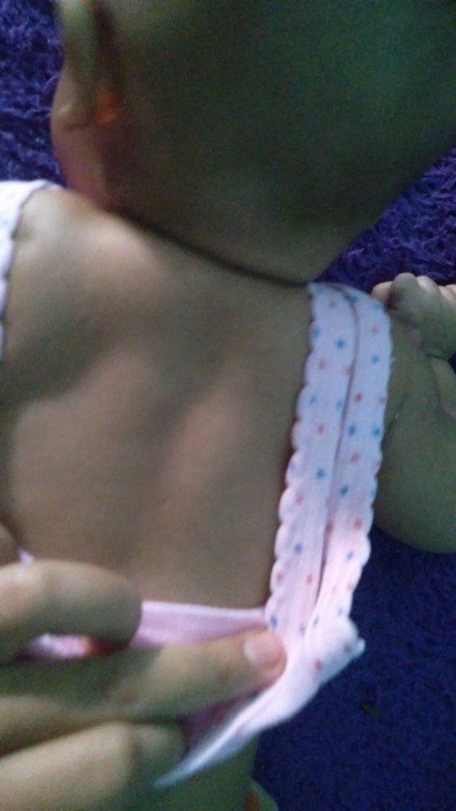 Bintik bintik putih di badan bayi bawahnya bahu itu kenapa ya Bun 
Cara mengatasinya gimana