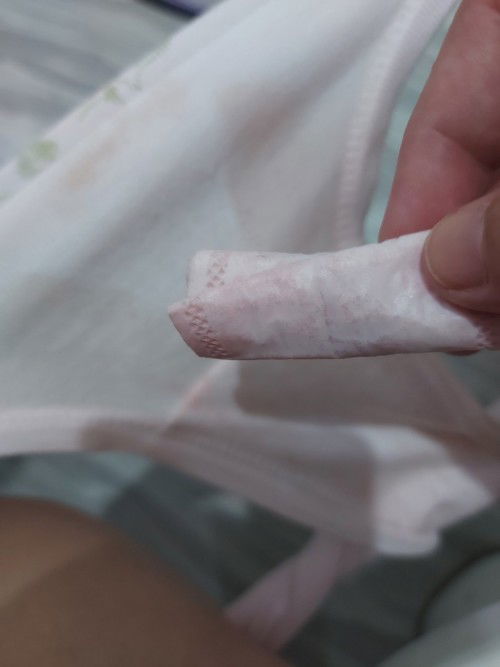 Pinkish discharge sa 37w 4d