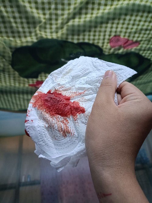 ขอสอบถามหน่อยคะ คลอดตั้งเเต่วันที่13ธันวา เลือดแดงไม่จางลงสักที ปกติไหมค่ะ