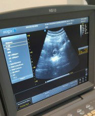 Usia USG lebih muda 3 minggu dari HPHT?