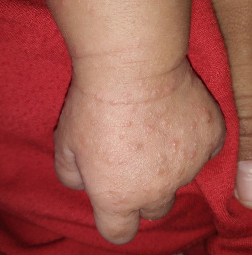 Penanganan Yang Ampuh