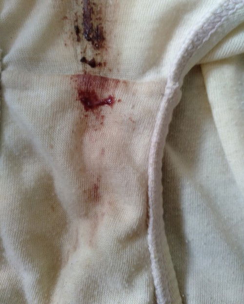 mucus plug naba ? EDD : January 11