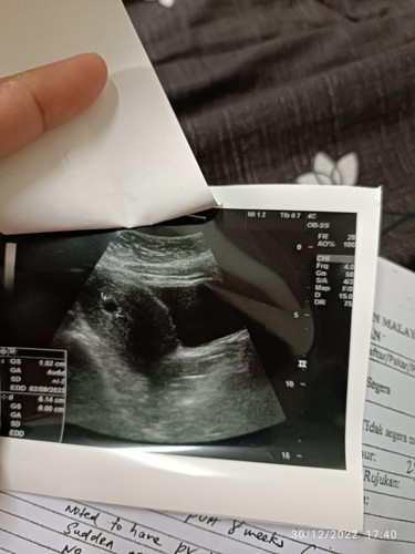 8minggu kantong masih kosong