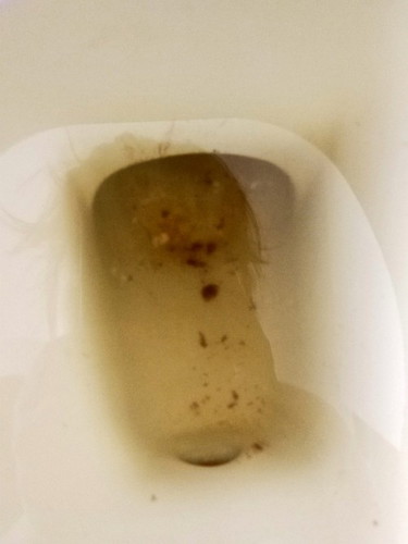 สอบถามแม่ๆค่ะ