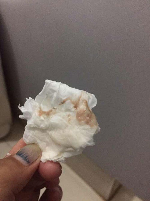 Lendir atau flek coklat di kehamilan 32 minggu