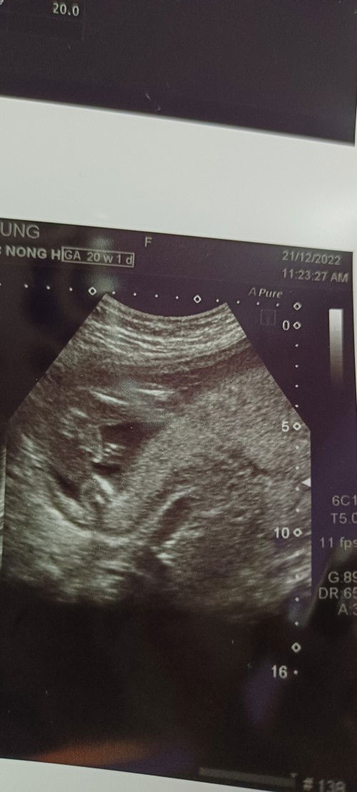 แบบนี้เป็นผู้หญิงหรือผู้ชายคะ