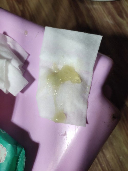 ask ko lang po,, may lumabas kase sakin na discharge dis morning