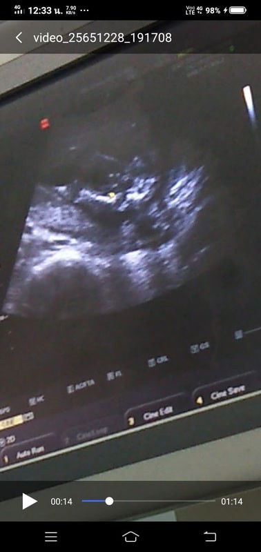 ท้อง 2 แล้วค่ะ ช่วยตั้งชื่อให้น้องหน่อยค่ะ อยากได้อักษร ก ค่ะ🤱