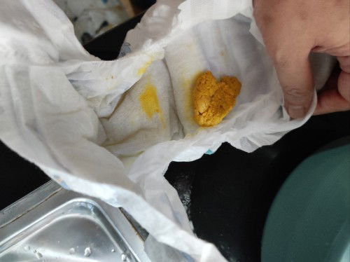 Sembelit atau normal untuk newborn 1 bulan 17hari