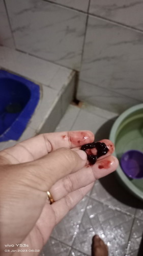Hasil tespek positiv. Tpi selama kehamilan selallu flek bila kelelahan. Kamarin keluar darah .