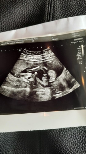 Its a BOY !!