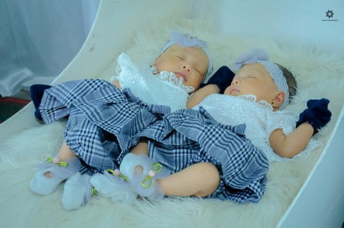 Cara mengatasi belekan pada bayi