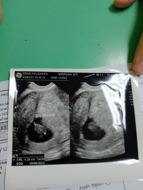 Ddj tidak terdeteksi