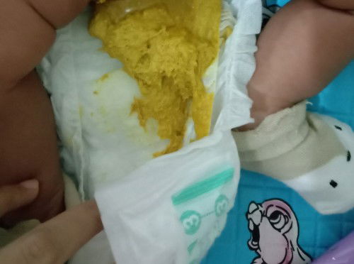 Bun, anak saya 1 bulan 10 hari. 2 hari ini BAB sehari sekali tapi banyaak. Berbahaya tidak ya?