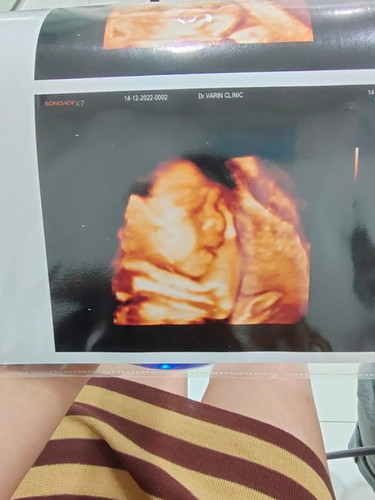 ลูกชายคนแรก👶🏻