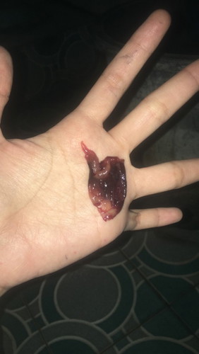 Pliss Bun yg tau atau berpengalaman ke aku.,tolong kasi tau yah ini darah head atau darah keguguran.