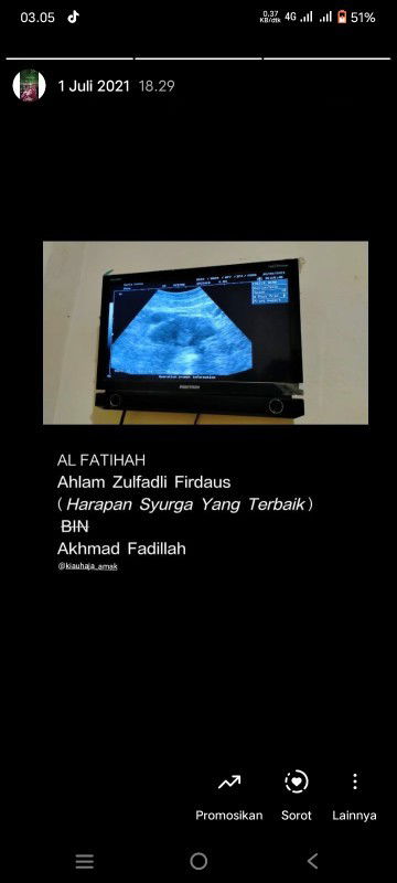 Keguguran di usia kandungn 4 bulan