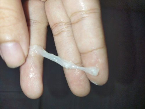 มูกใสหรือเปล่า