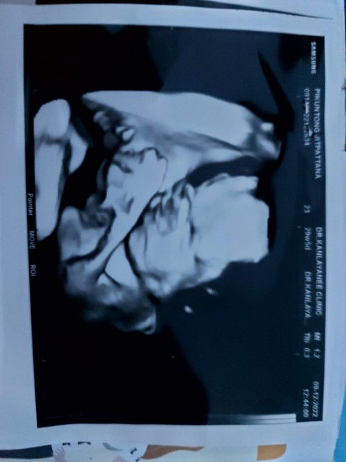 อยากให้แม่ๆแนะนำชื่อหน่อยค่ะ น้องเป็น ผช. ชื่อพ่อตัว ฮ.
ชื่อแม่ตัว ก. มีชื่อเพราะๆเเนะนำหน่อยนะคะ😊