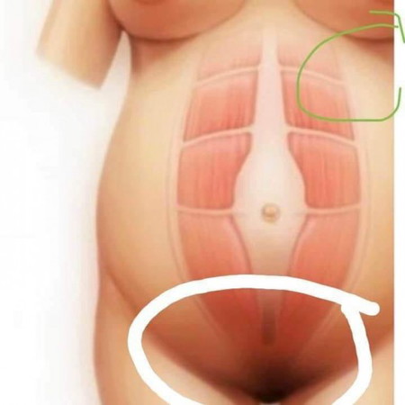 ปวดท้องปวดหลัง
