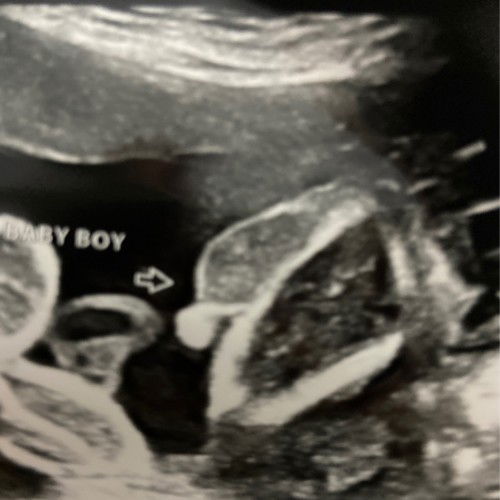 Betul ke boy ye? Tak pandai betul tengok..tekebil kebil menelek