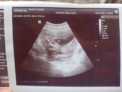 ภาพซาวด์แบบนี้ ผู้หญิง หรือ ผู้ชายคะแม่ๆ