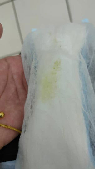 Tolong saya , ni maksudnya ada nifas lagi or x?