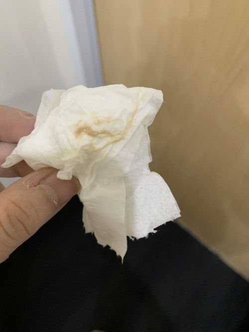 Flek kehamilan 6week