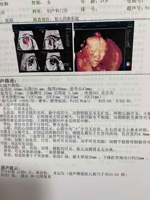 สอบถามผู้รู้ค่ะ