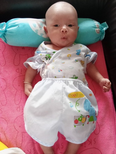 ดัดขาน้อง วัยแรกเกิด
