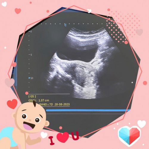 Cuma mau cerita ya mom