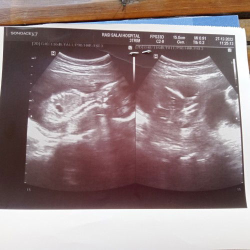 น้องเป็นผู้หญิงหรือผู้ชายคะ