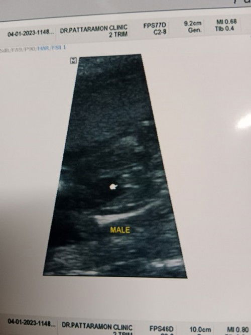 ผช.จริงๆใช่มั้ยย?😅