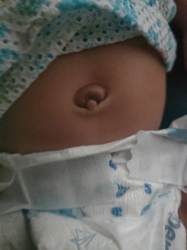 Bayi 1 bulan 5 hari