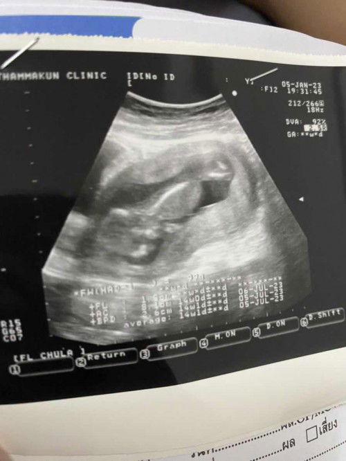 แม่ๆช่วยตอบหน่อยค่ะ🥺