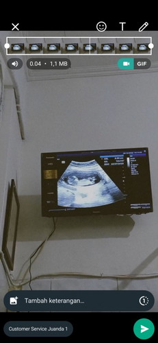 Halo, assalamualaikum bunda" cantik, aku mau tanya, kalau jenis kelamin bisa diliat USG brp bulan ya
