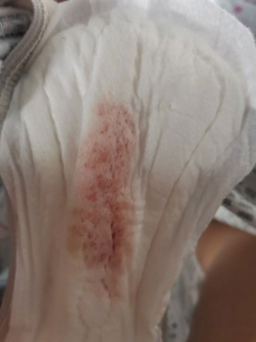 Mens sa Breastfeeding moms