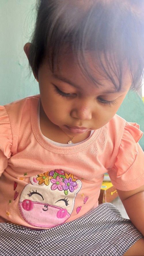 Hidung merah , biang kringat ?