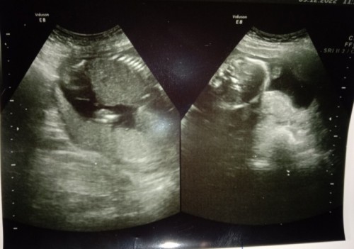 น้องเป็นชายรึหญิง