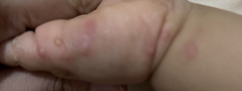 Hello mga mommy ano po kaya itong natubo sa anak ko