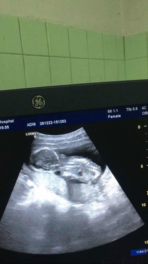 ทีมตลอดมิถุนายนจ้า