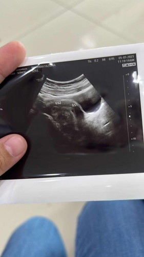 Baby twin sy xnak duduk rapat2