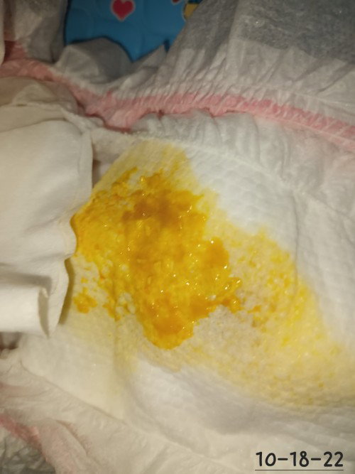 Breastmilk reaction?