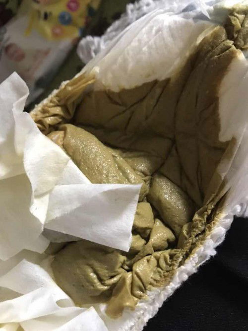 BAB Bayi usia 4 bulan 19 hari