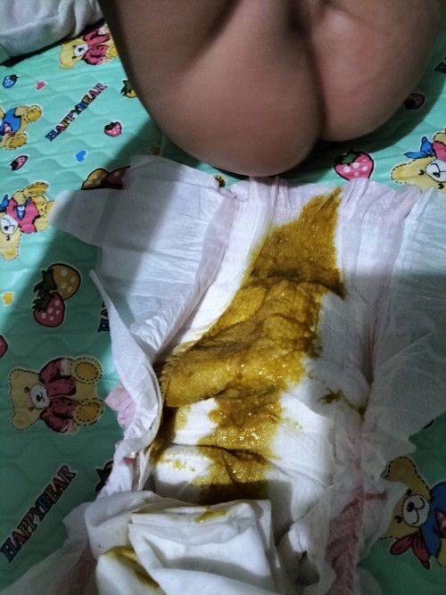 Poop 3months old please help Po.