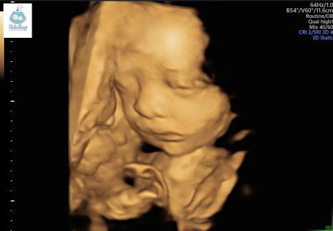 Pregnancy Update - 28 Weeks