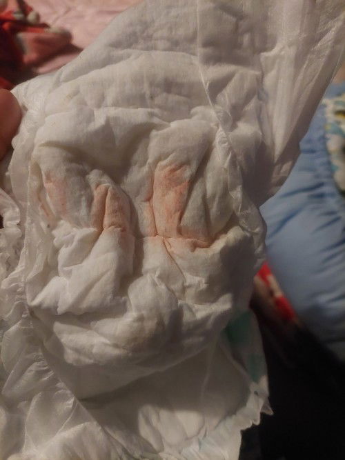 ท้องแรก ช่วยกันตอบหน่อยค่ะแม่ๆ 😔