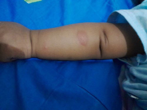 Buletan Merah, apakah itu?