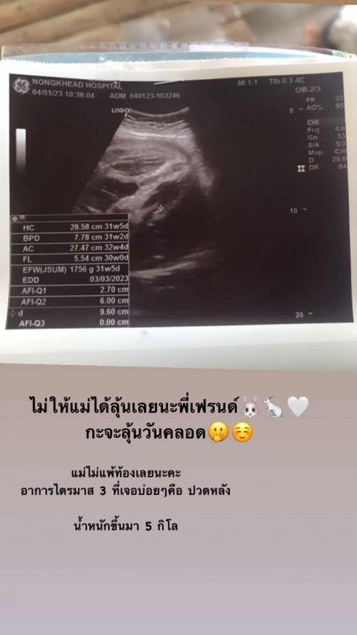 ไม่ได้ลุ้นเลยยย